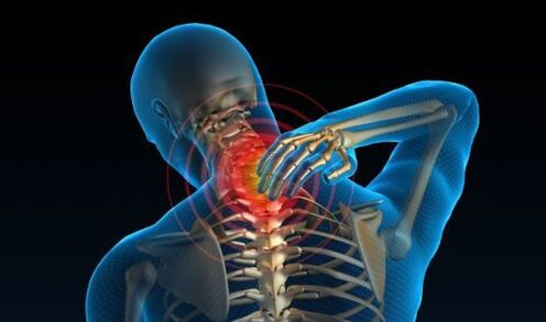 Schmerzen in der Halswirbelsäule mit Osteochondrose