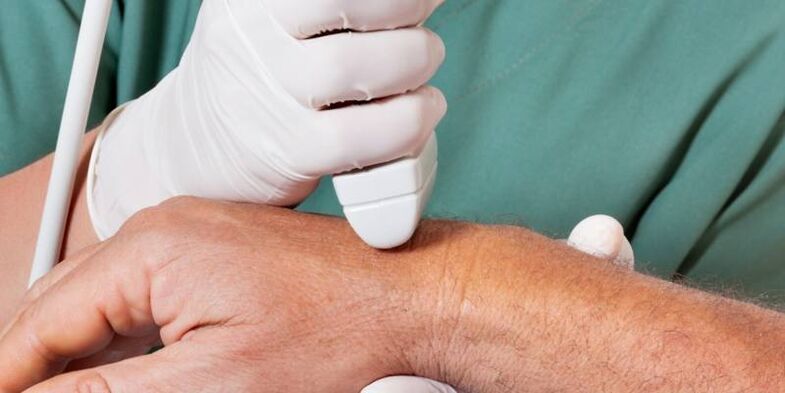 Arthritis als Ursachen für Schmerzen bei Fingern