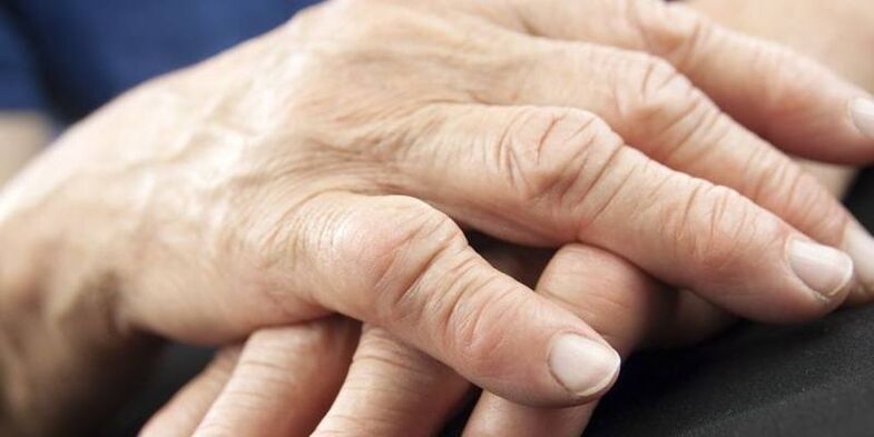 Was Pathologien Finger tun